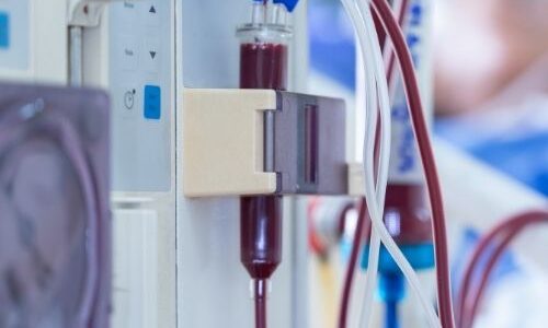 Dialysis Technology